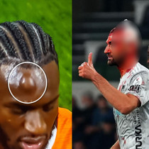 Süper Lig'de korkutan an! Kanlar içinde maça devam etti