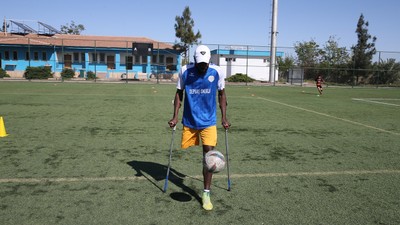 Bir ayağını kaybetse de futbol sevgisi bitmedi