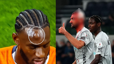 Süper Lig'de korkutan an! Kanlar içinde maça devam etti