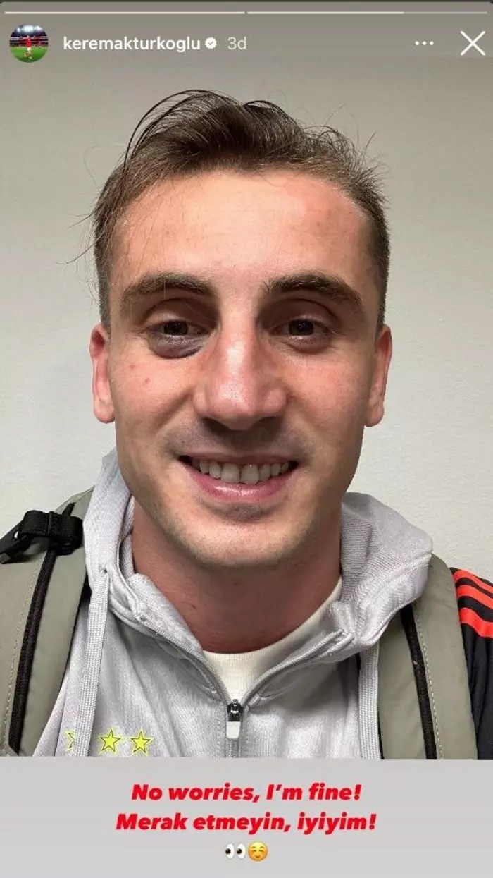 Gözüne darbe alan Kerem Aktürkoğlu'ndan maç sonu paylaşım - Resim : 1