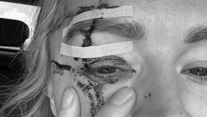 Ünlü spor sunucusu Laura Woods ölümün eşiğinden döndü! Hayatını şokunu geçirdi... - Resim: 4