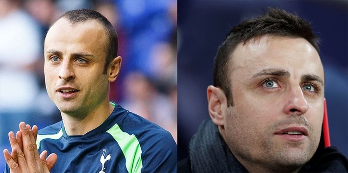 Saç ektiren futbolcular! Listeye çok şaşıracaksınız - Resim: 2