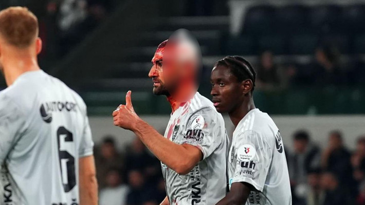 Süper Lig'de korkutan an! Kanlar içinde maça devam etti - Resim: 3