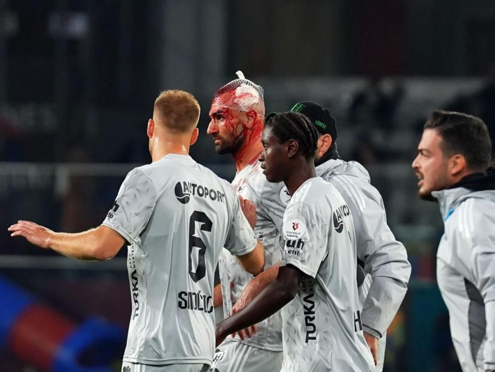Süper Lig'de korkutan an! Kanlar içinde maça devam etti - Resim: 4
