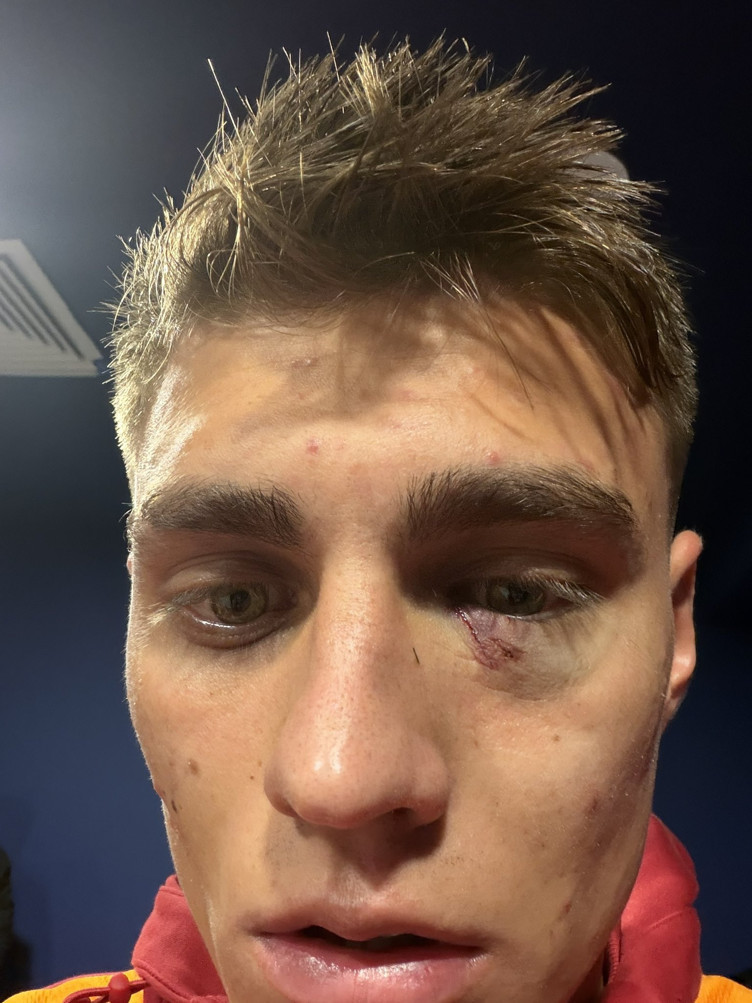 Yüzünden yaralanan Kazımcan Karataş için destek paylaşımı - Resim : 1