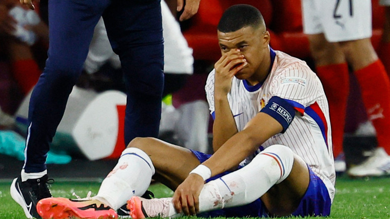 Kylian Mbappe'nin burnu kırıldı
