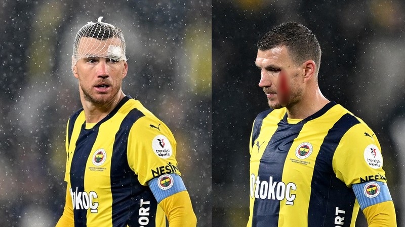 Edin Dzeko'nun yediği kafaya ilginç yorum: Takla atardı!